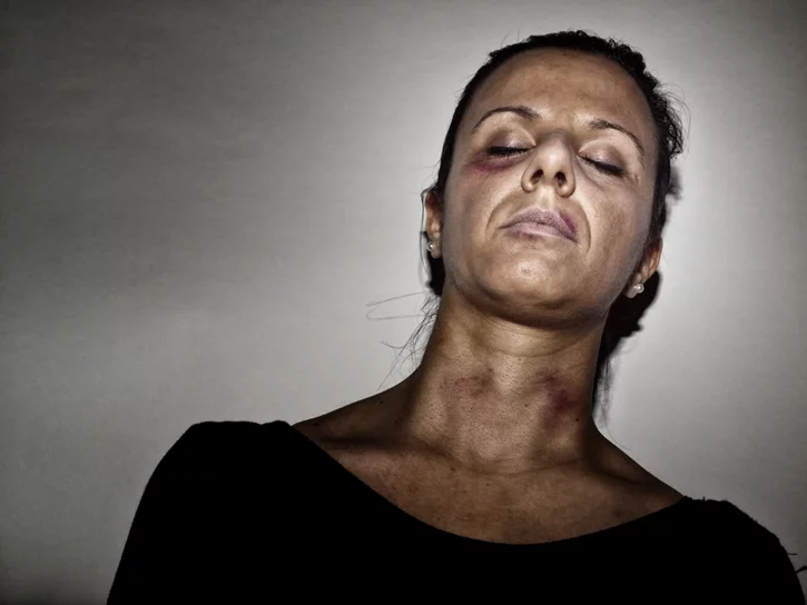 a dead woman photographed with a flash, lying with her head against the wall, 